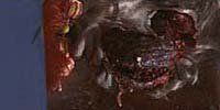 Image from: Parasite (1982)